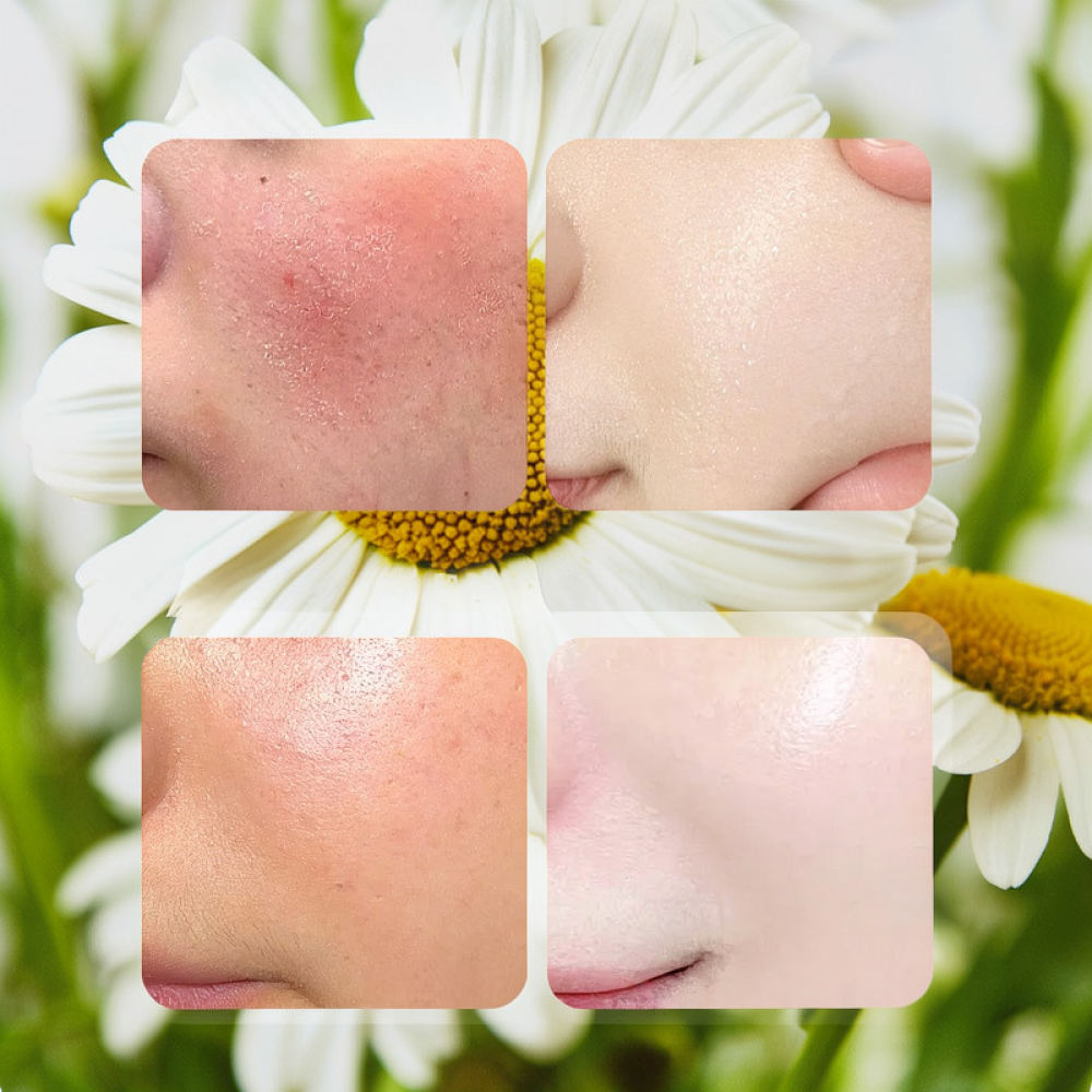 Face Mask Skincare - Fykly ローズVC カモミール B5 ビタミン配合 フェイシャルマスクシート