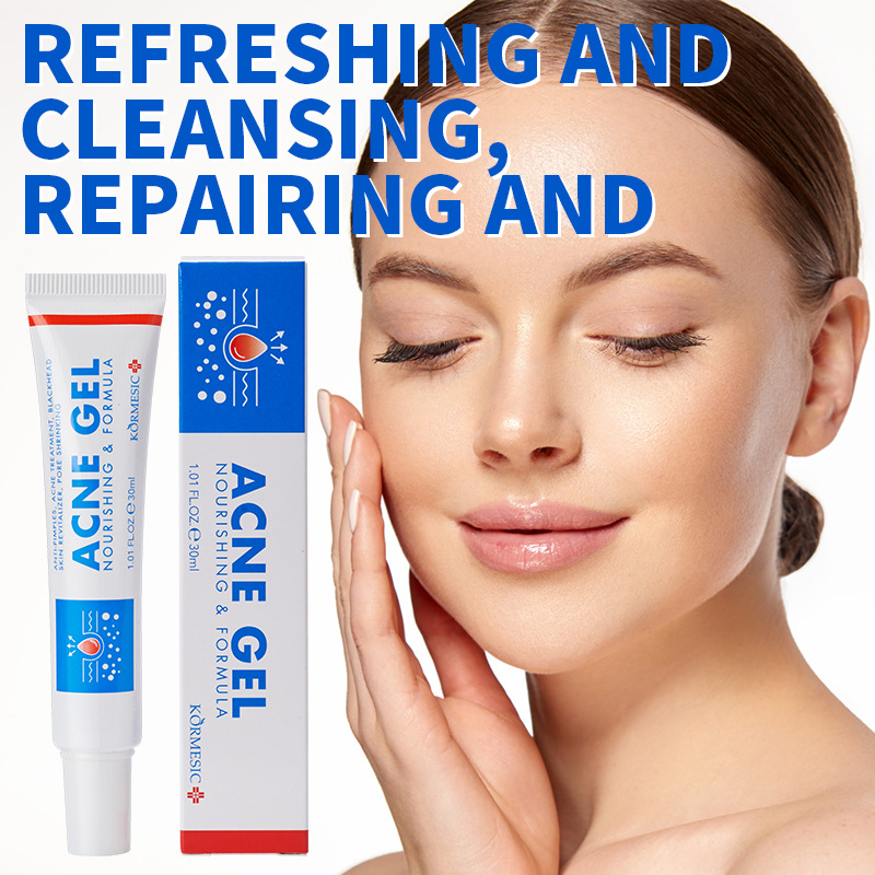 Face Moisturizer - 30gのニキビ除去ジェル。毛穴の奥までしっかり洗浄し、ニキビを防ぐクリーム。